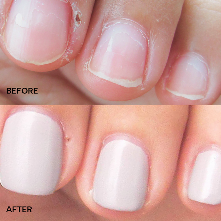 Curb No Bite Nail & Cuticle Treatment