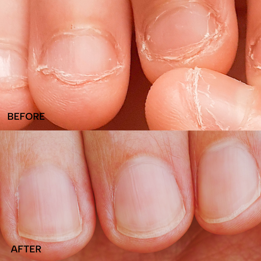 Curb No Bite Nail & Cuticle Treatment